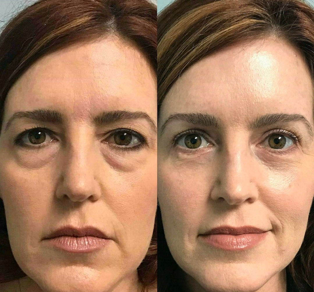 Eye Tightening Cream